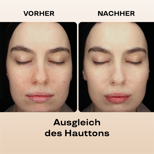 Feuchtigkeitsspendende BB Cream LSF 15 (110/Light) 